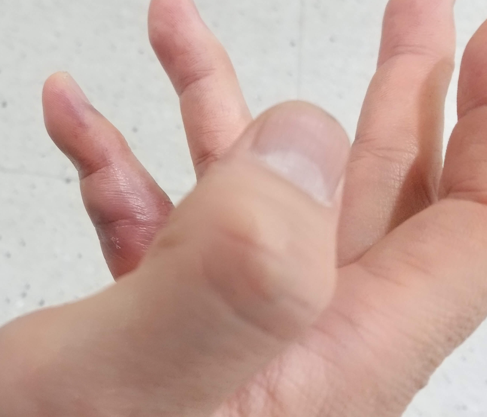 2월8일손가락구부림정도사진2