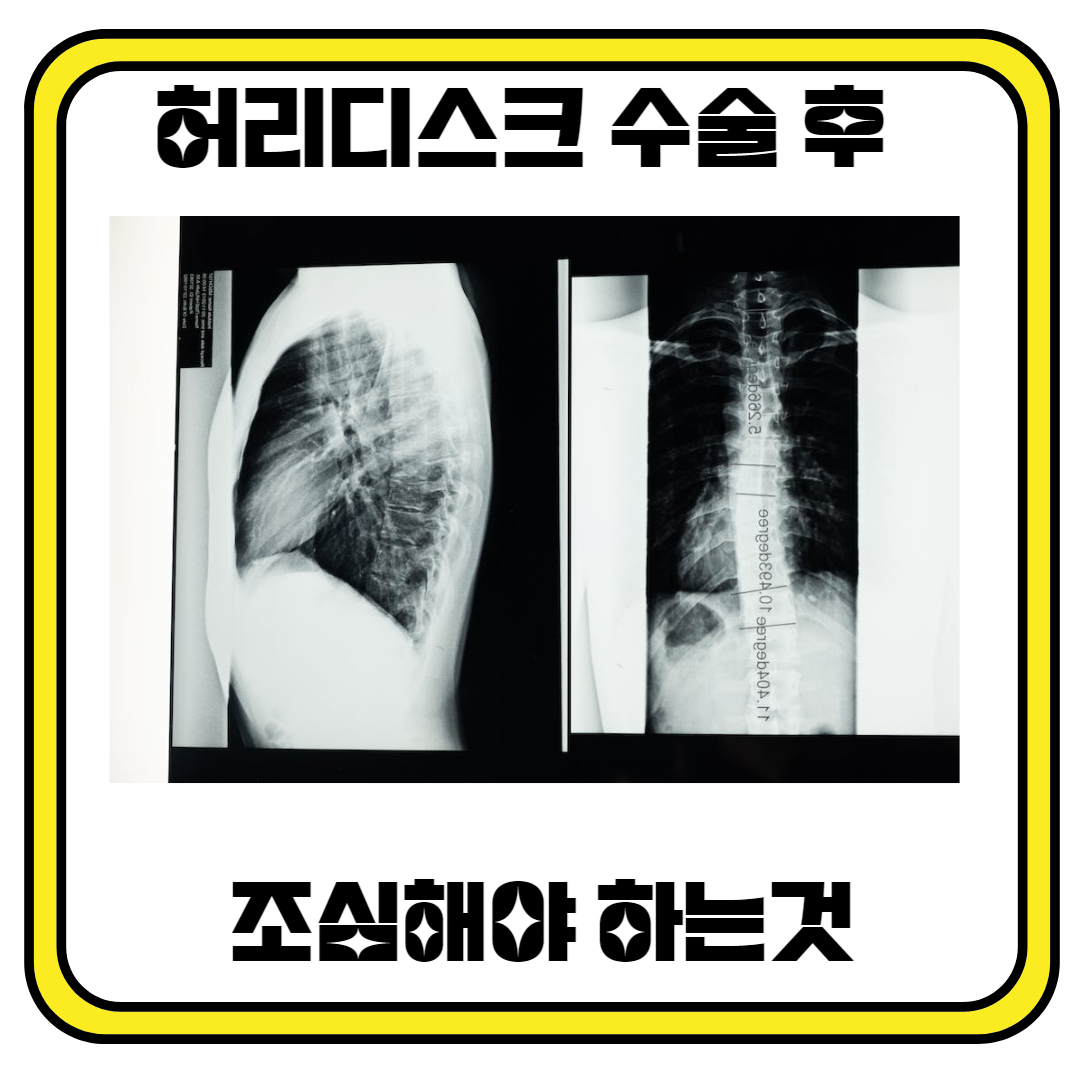 허리디스크 수술 후 조심해야 하는 것