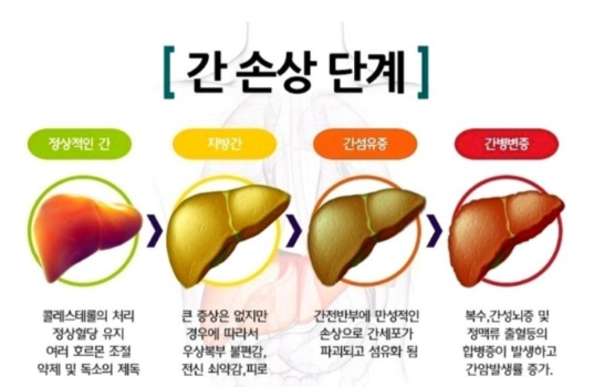 지방간의 원인부터 예방법까지 관련 이미지