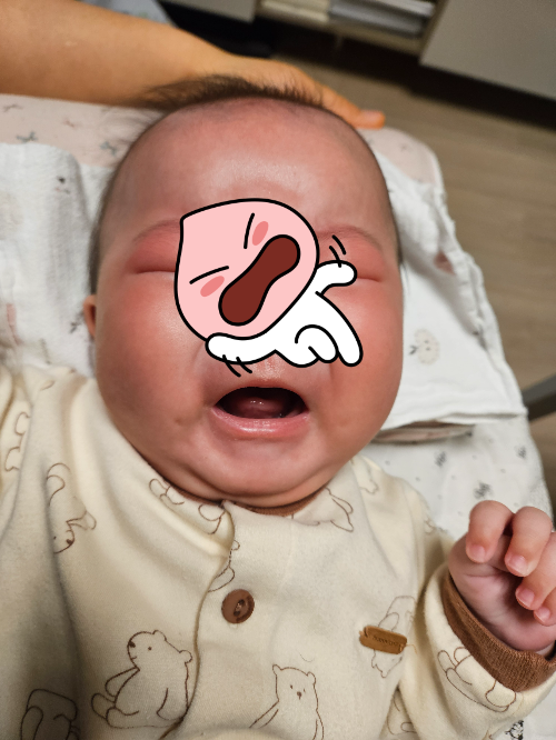 4개월 아기의 마른기침