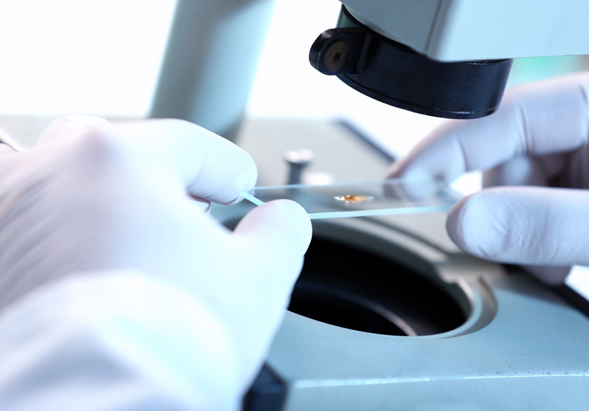 현미경과 디지털 모니터로 병리 슬라이드를 분석하는 장면