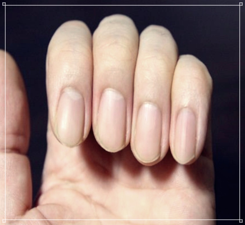 손톱 건강을 위한 일상 속 쉬운 손톱파임 예방법.