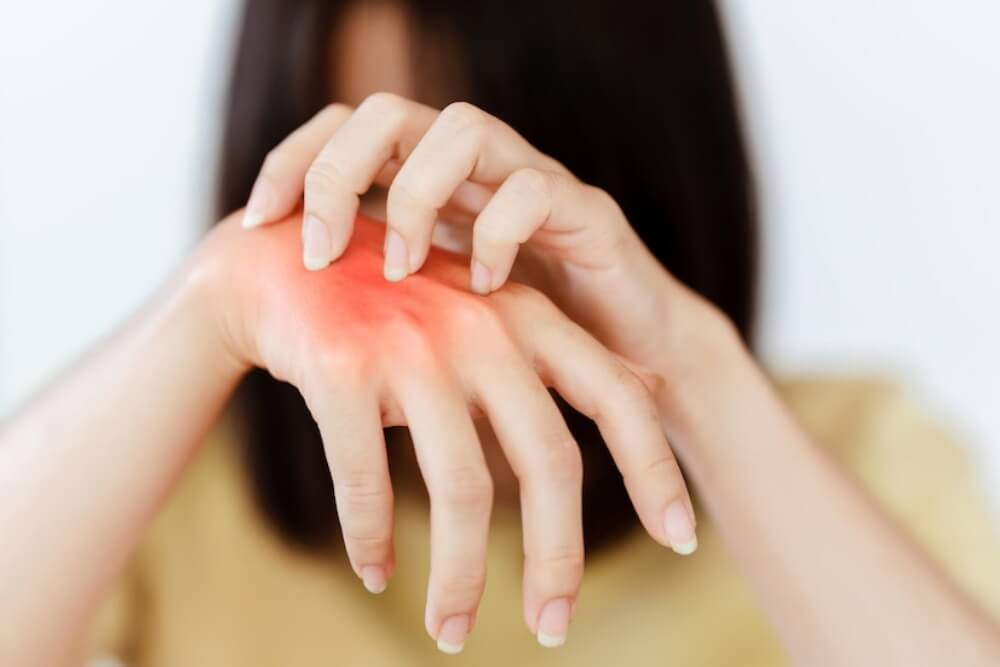 손을 긁고 있는 여성