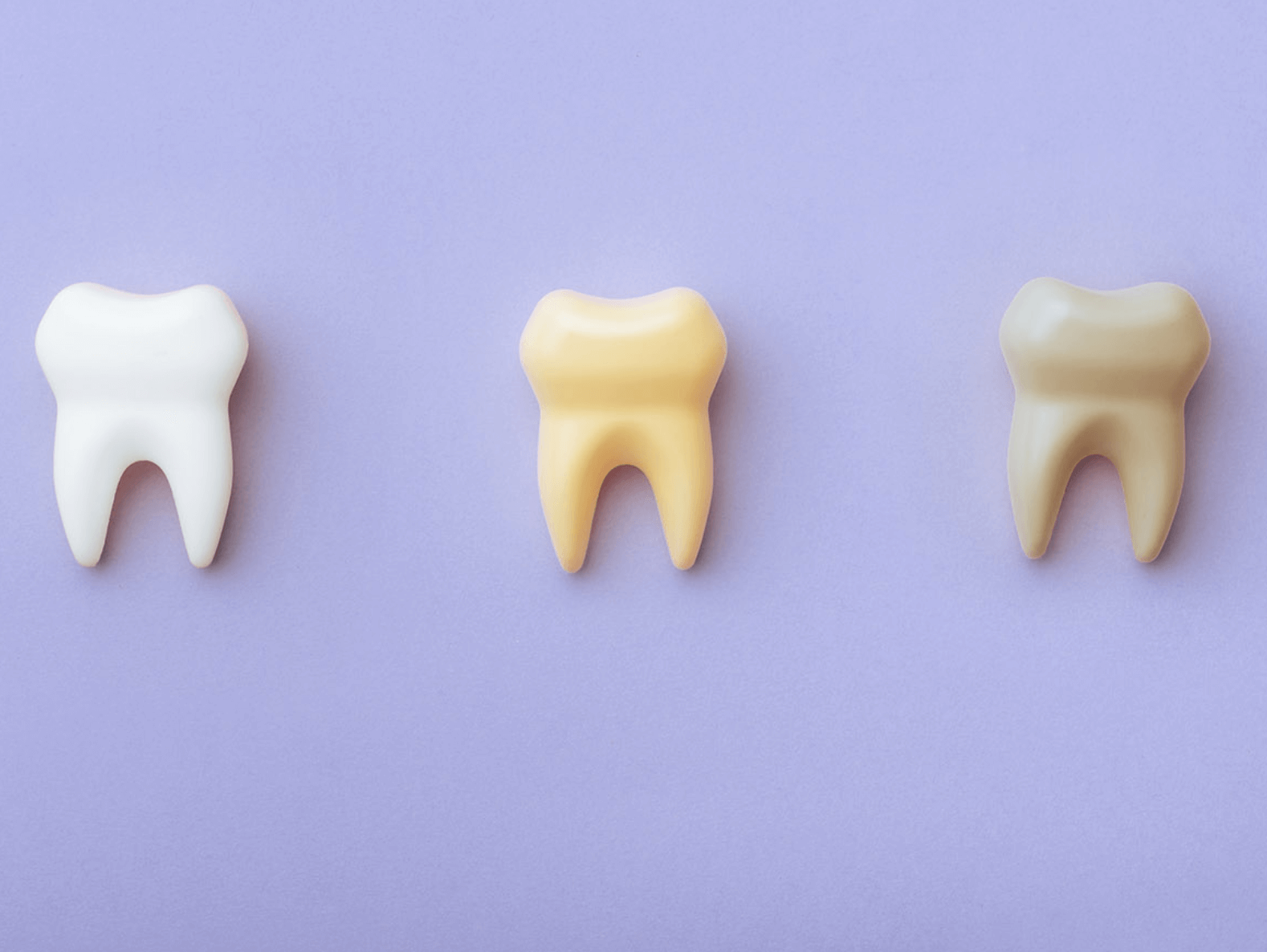 치아 변색 원인