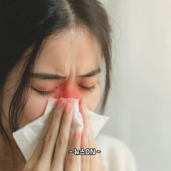 부비동암 생존율