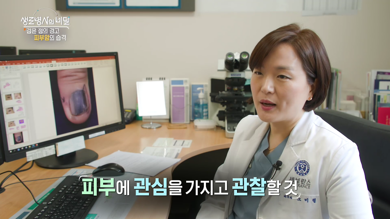 생로병사의 비밀 피부암 검은점