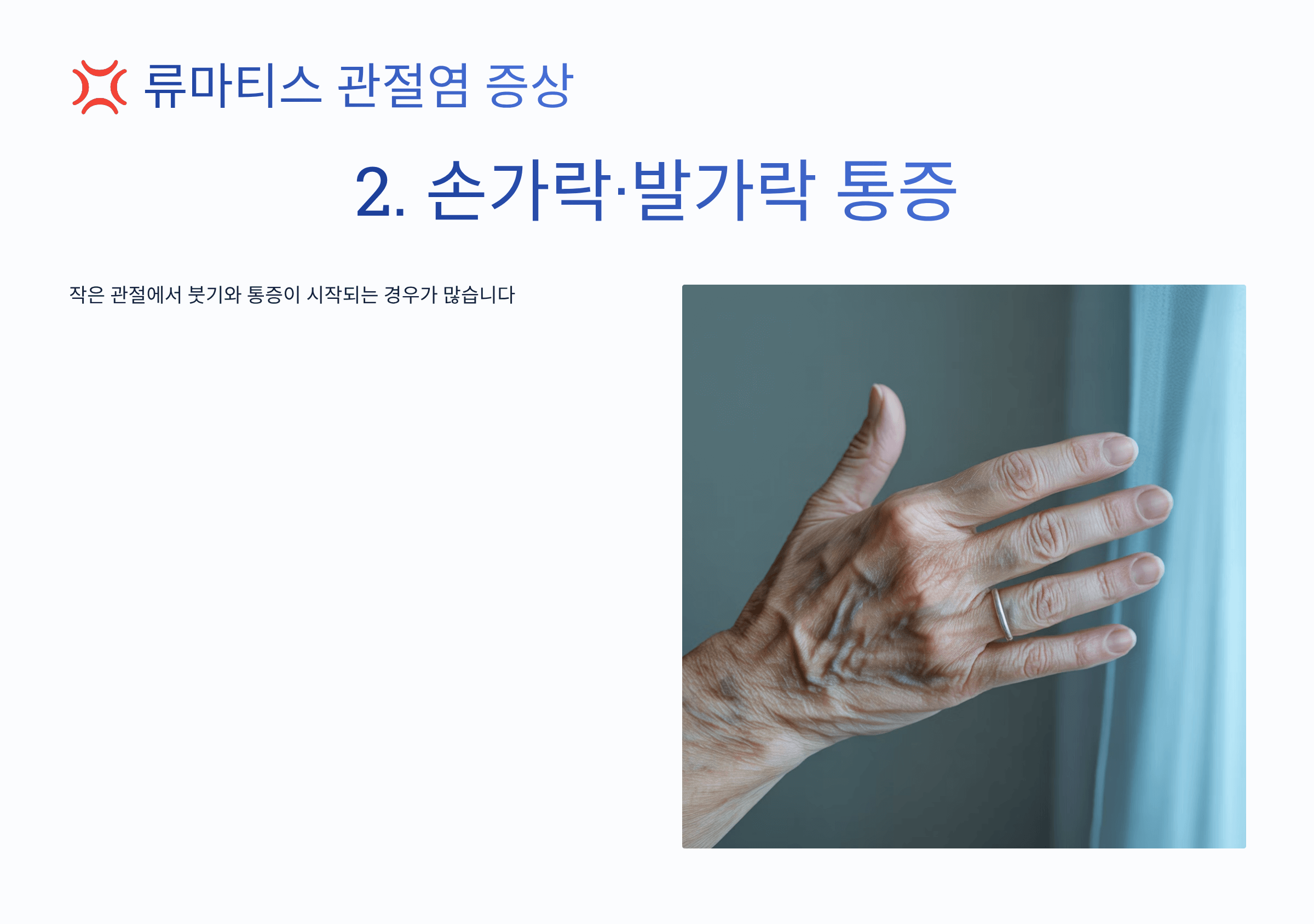 류마티스 관절염 사진입니다.