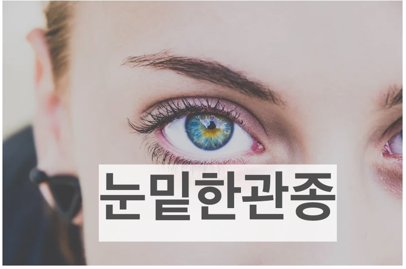 눈밑한관종 생기는 원인 및 해결방법