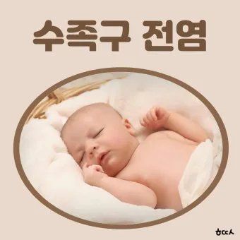 수족구 어른 전염에 대한 원인과 예방법 정리_15