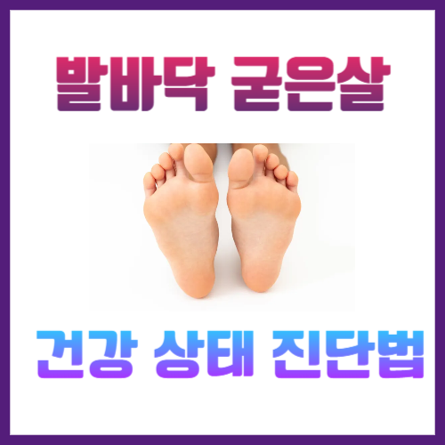 발바닥굳은살