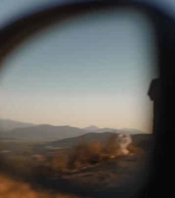 황반변성 증상 원인 치료법