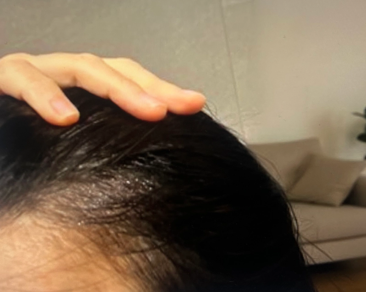 엠자 심한 사진