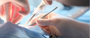 치과 치료비 건강보험 적용 범위 체크하기