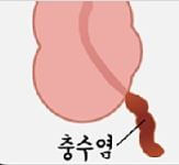 맹장 위치