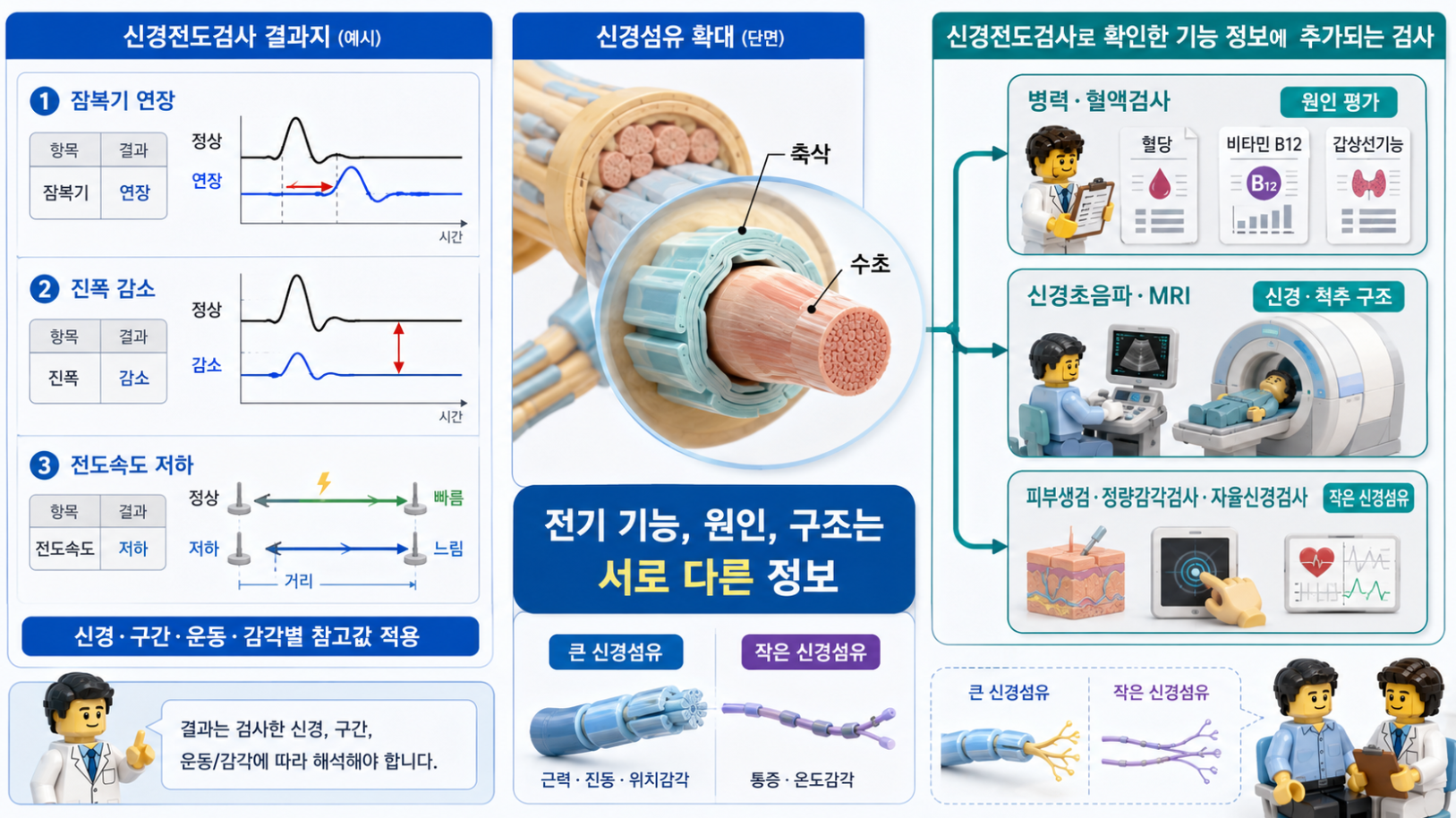 신경전도검사 결과지의 잠복기·진폭·전도속도와 추가 평가 정보를 설명하는 의료 인포그래픽