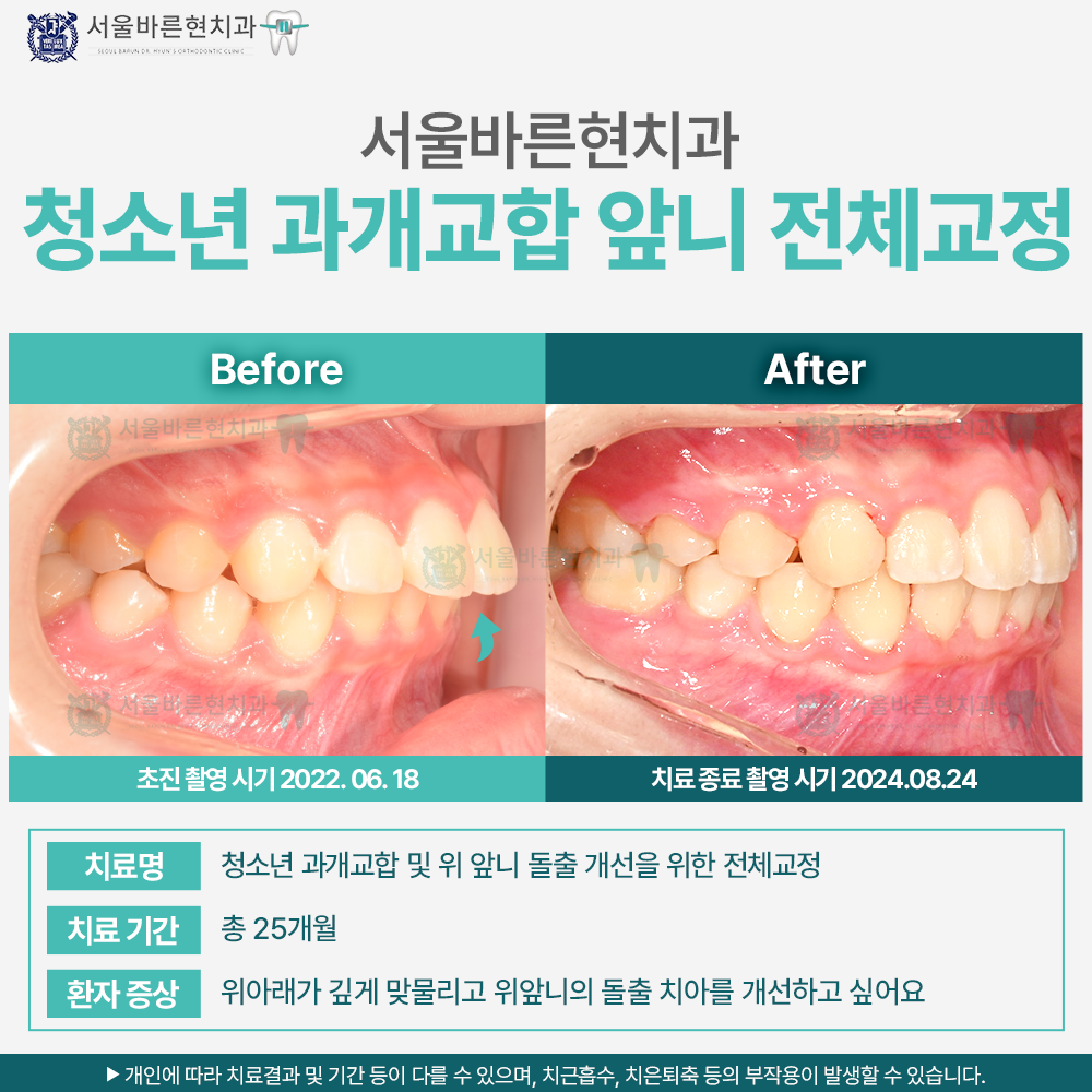 해운대교정치과