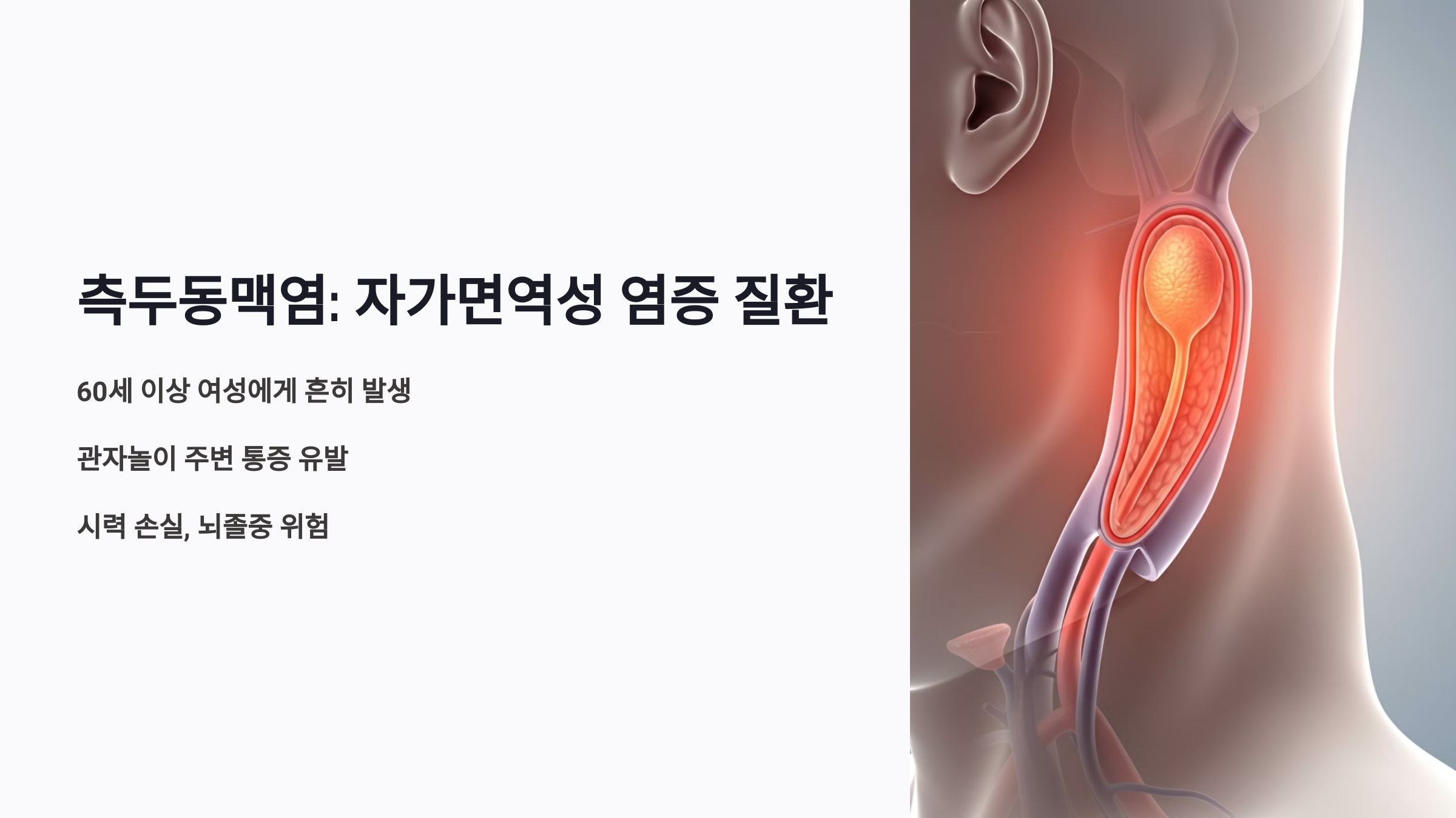 측두동맥염