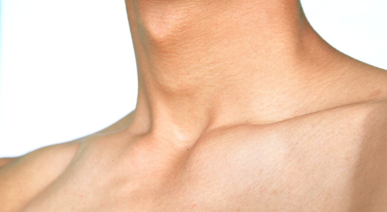 림프절이 있는 쇄골