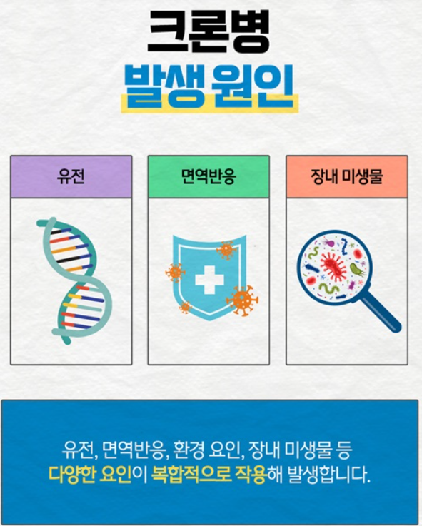 크론병 발생 원인