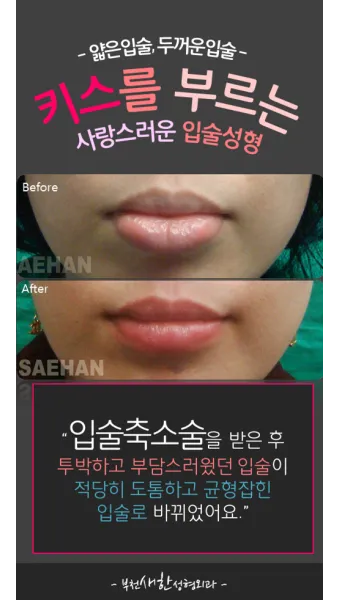 입술 두꺼운 남자 관상 특징과 해석_17