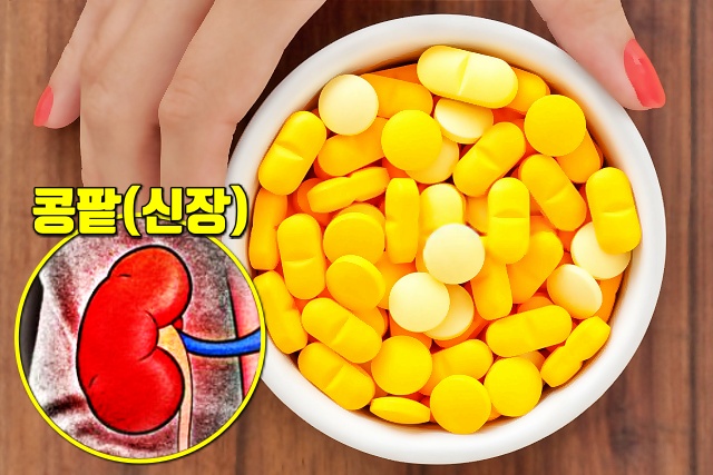 비타민D 비타민C, 콩팥병, 질환별 피해야할 건강식품,건강,팁줌 매일꿀정보