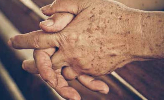 검버섯 없애는 방법