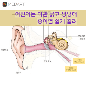 중이염 원인과 치료