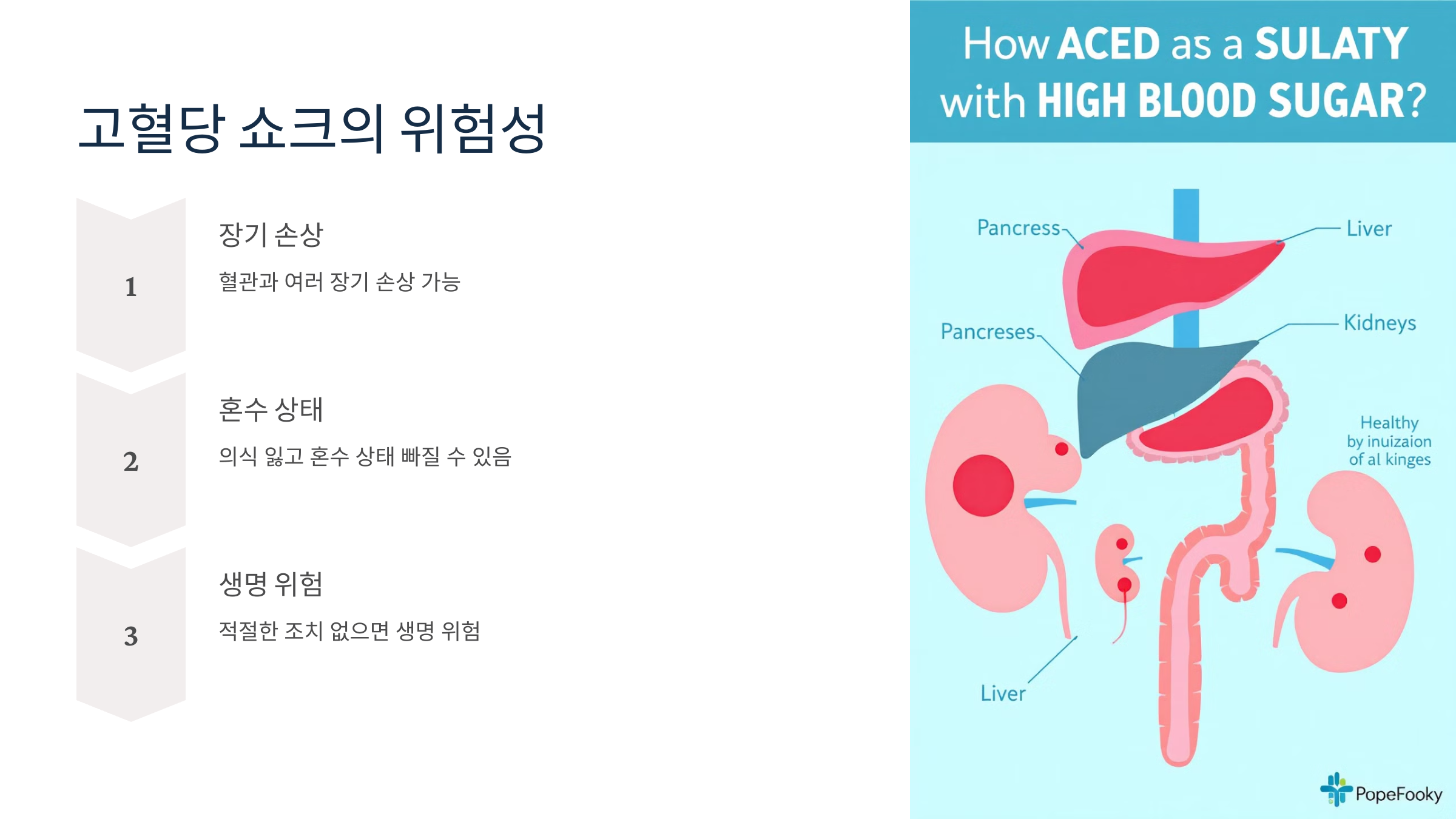 고혈당 쇼크 증상