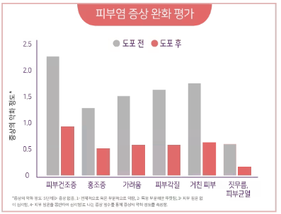 비판텐-연고-얼굴