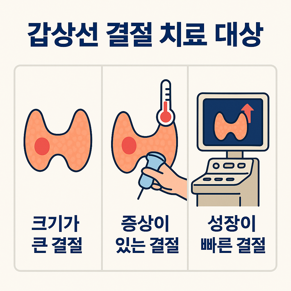 갑상선 결절의 치료대상을 설명하는 이미지