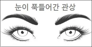 눈이 푹들어간 관상