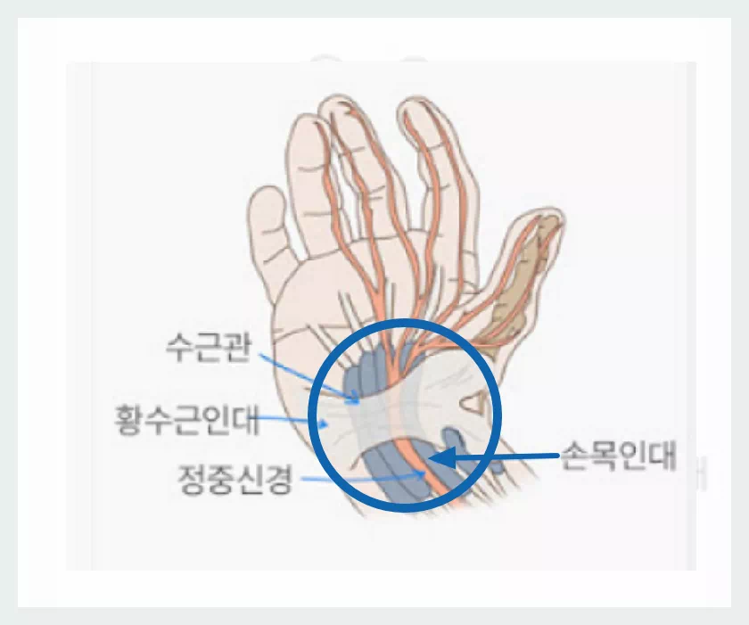 손목구조