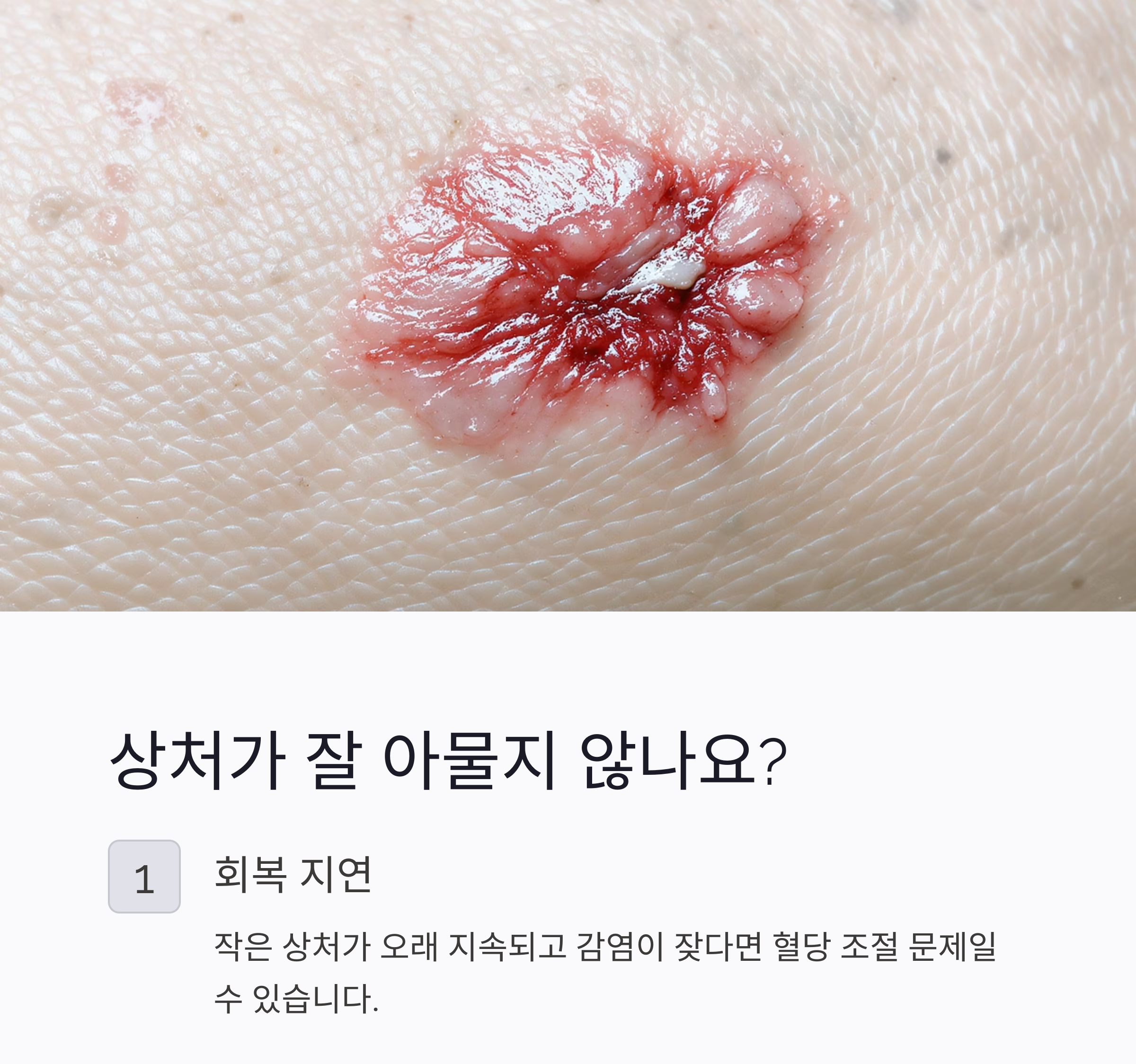 당뇨 초기 증상, 절대 놓치지 말아야 할 신호 7가지
