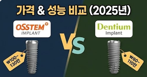 오스템 vs 덴티움 가격 및 성능 비교