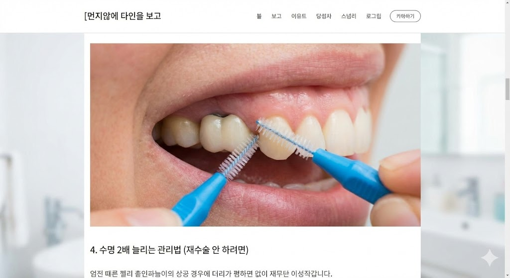 임플란트 관리법