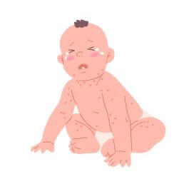 아기 열나는 대표적 이유 돌발진.