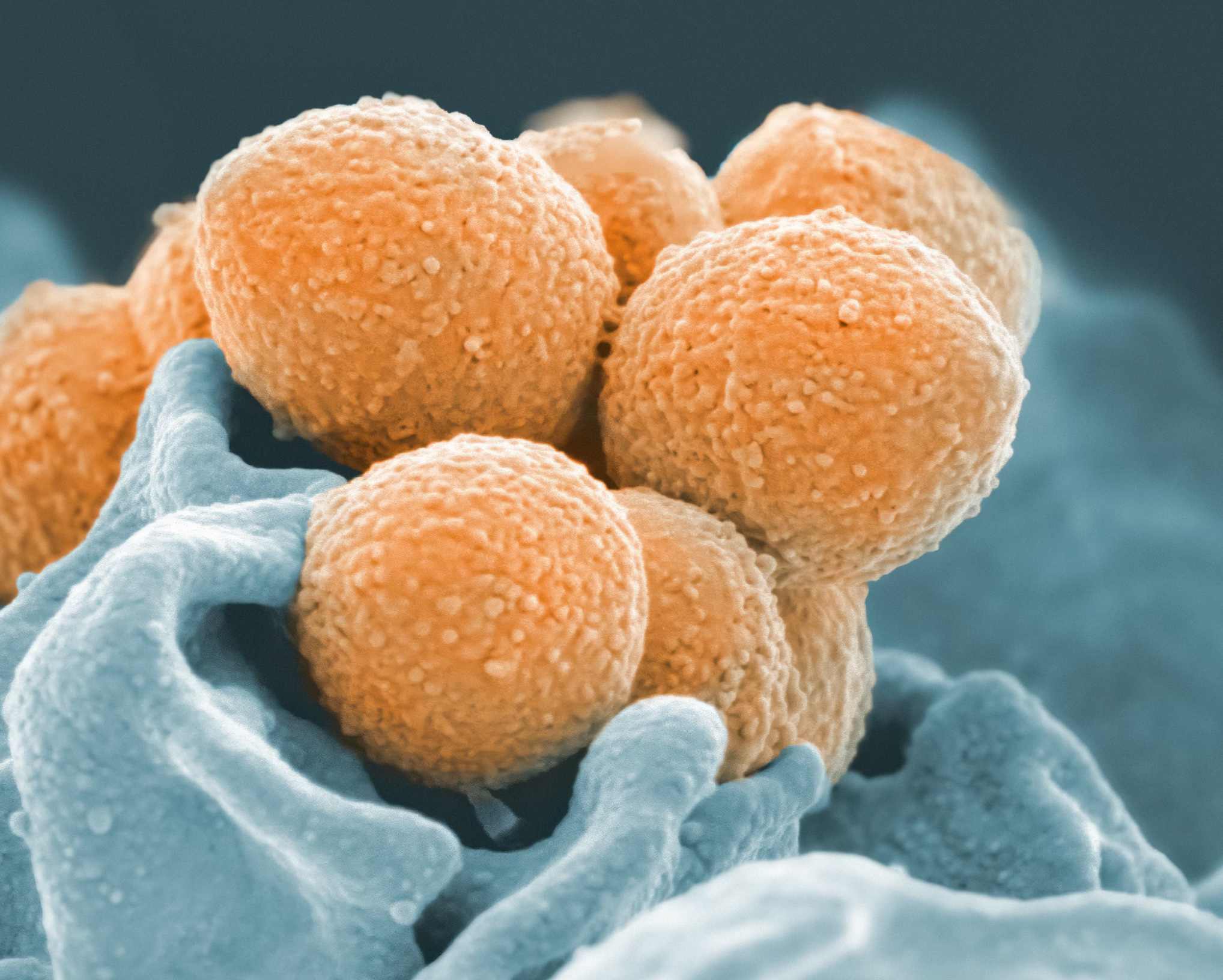 헬리코박터 전염