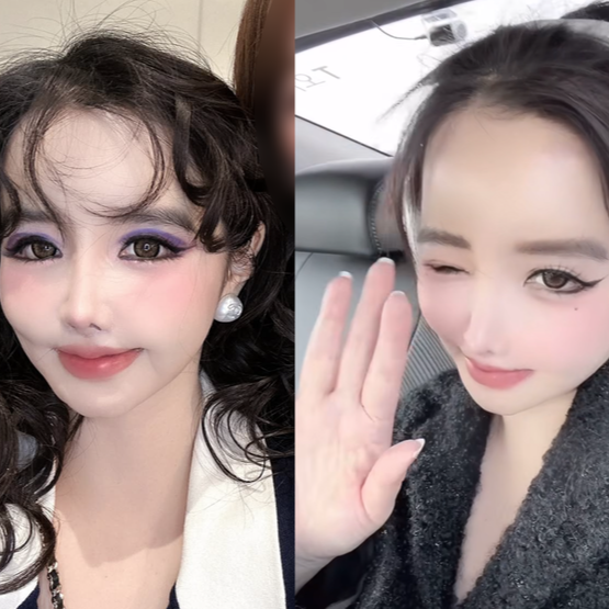 박봄