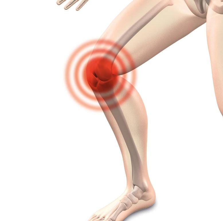 통풍 원인 초기 증상 치료법(+자가진단표)