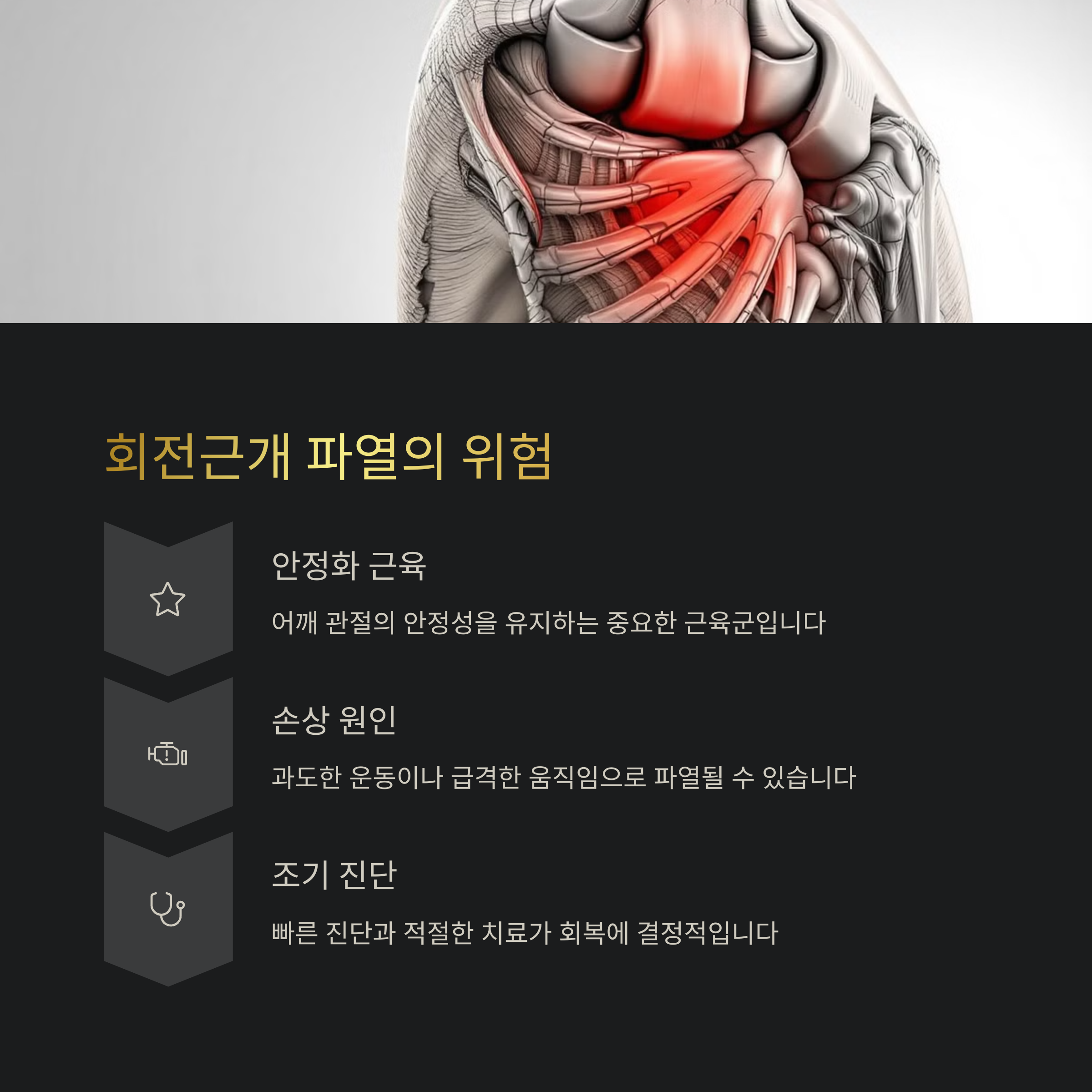 회전근개 파열의 위험