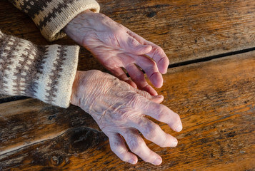 방아쇠수지증후군 통증 무시하면 안된다. 사용량이 많은 만큼 손목과 손가락에 생길 수 있는 질환도 많아 손 질환은 더 이상 생소한 질환이 아닌거 같습니다