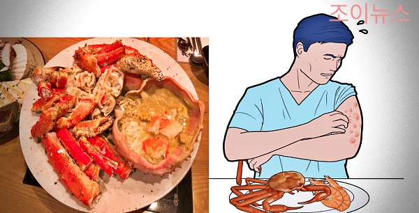 게(갑각류) 식품알레르기 증상