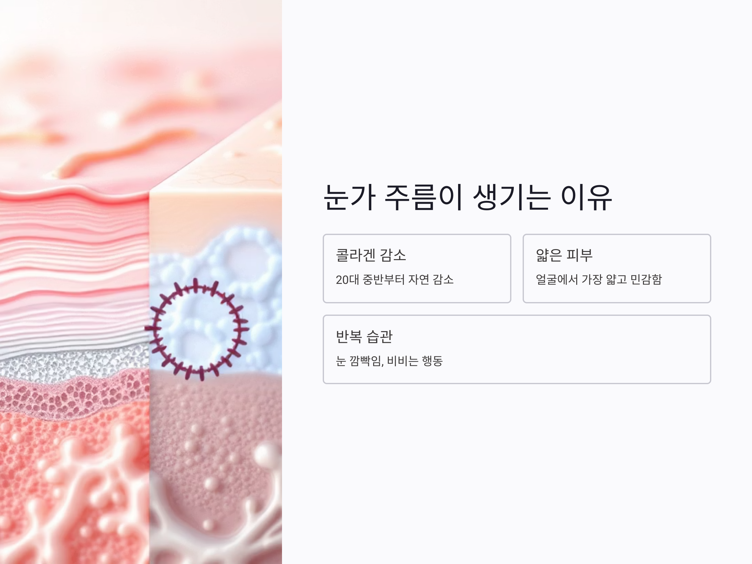 눈가 주름이 생기는 진짜 이유