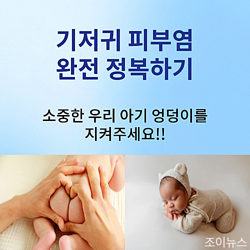 기저귀 피부염, 보습제 및 물티슈 기저귀 추천.