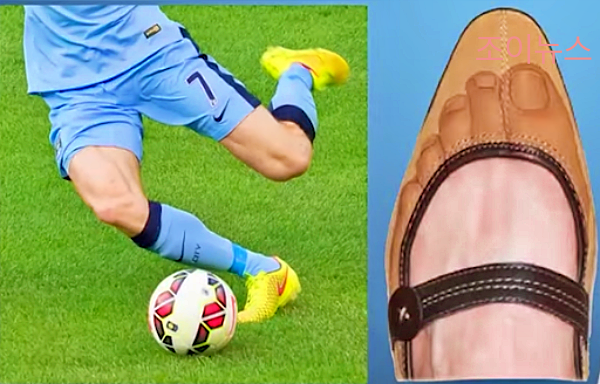 내성발톱 발생원인_출처:김범수교수의발편한세상