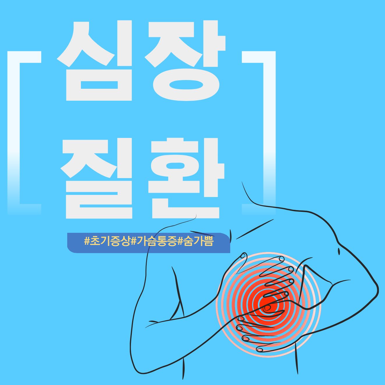 심근경색 전조증상 정리｜놓치기 쉬운 신체 변화