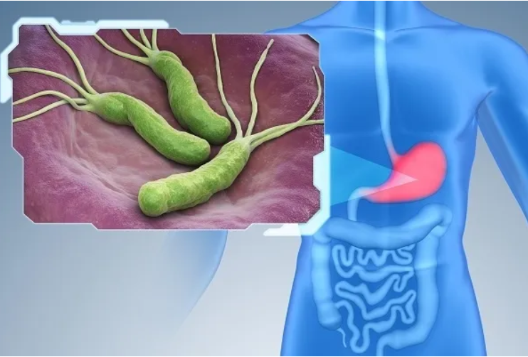 헬리코박터균-보균자-피해야할-것들-(커피?-소시지?-튀김?)