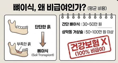 임플란트 뼈이식 비용