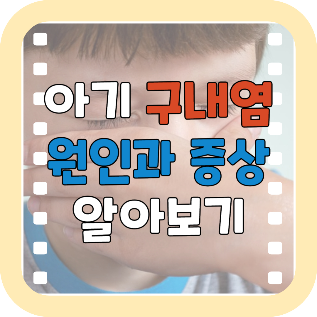 아기가 구내염 원인과 증상 알아보기