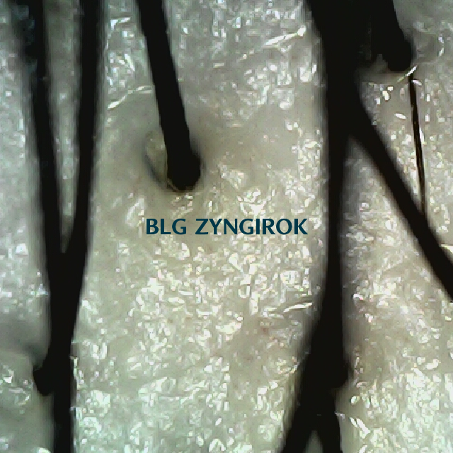 탈모 극복 프로젝트 - 뒷머리 두피 모습이다.